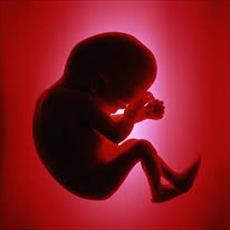 تحقیق سقط جنین